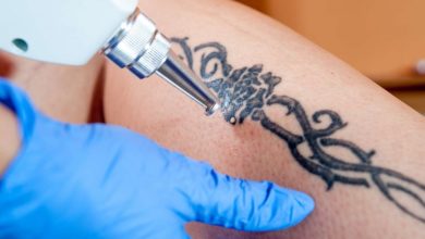 Get Your Tattoo Removed if You Do Not Like It Anymore