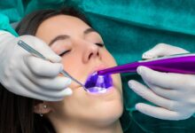 Dental Sealants Newport Beach