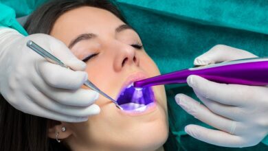 Dental Sealants Newport Beach