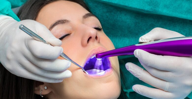 Dental Sealants Newport Beach